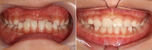 987ea29b9d8de943c8afaa67742acbf0_1598842814_1255.jpg