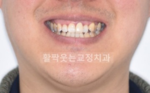 ccbfe25fe4a53c3c4a328497dc2f65cc_1615942176_0857.jpg